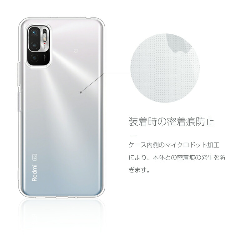 楽天市場】Redmi Note 10 JE XIG02 / Redmi Note 10T ケース 透明維持