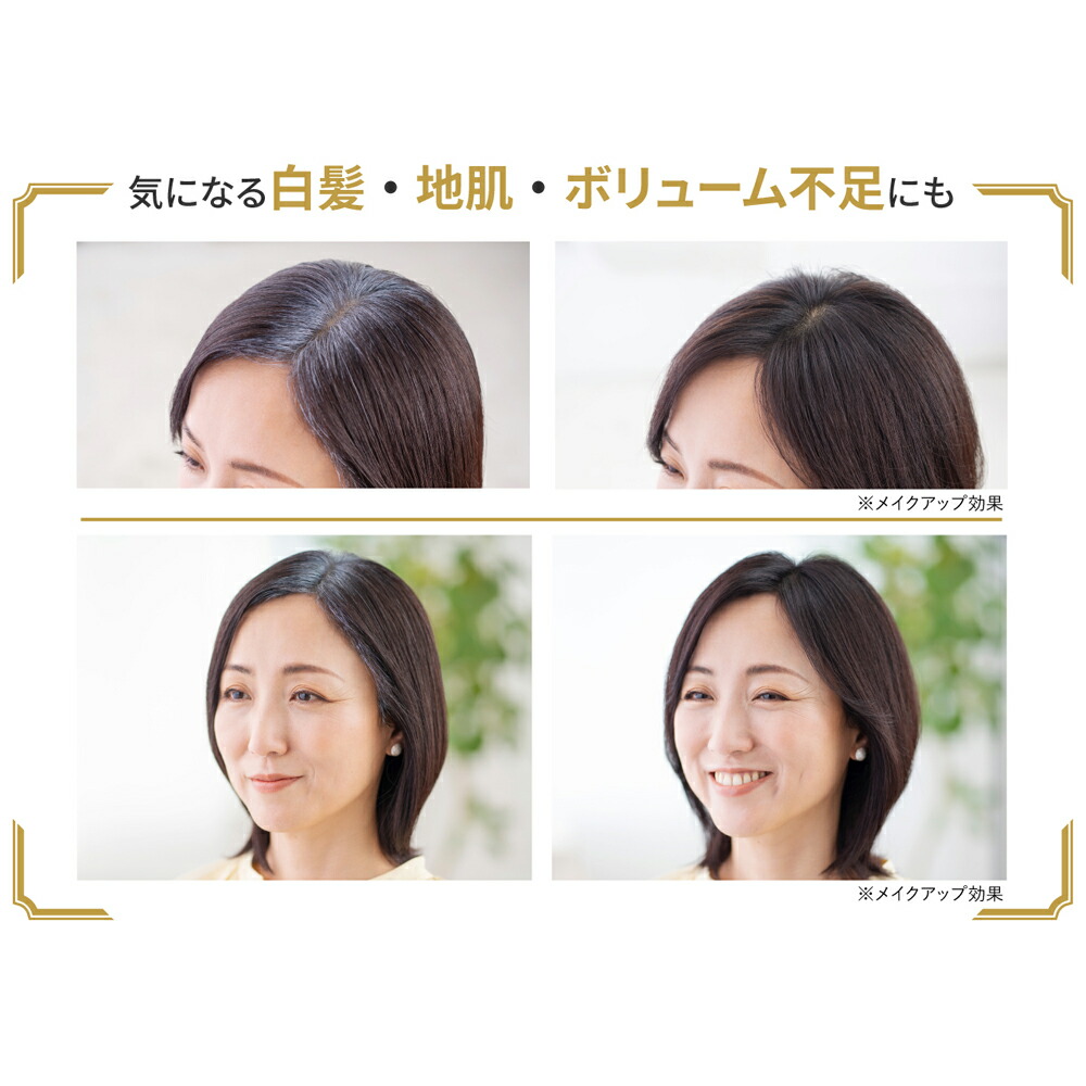 楽天市場】公式 アートネイチャー アートミクロン プラビ パウダー 8g