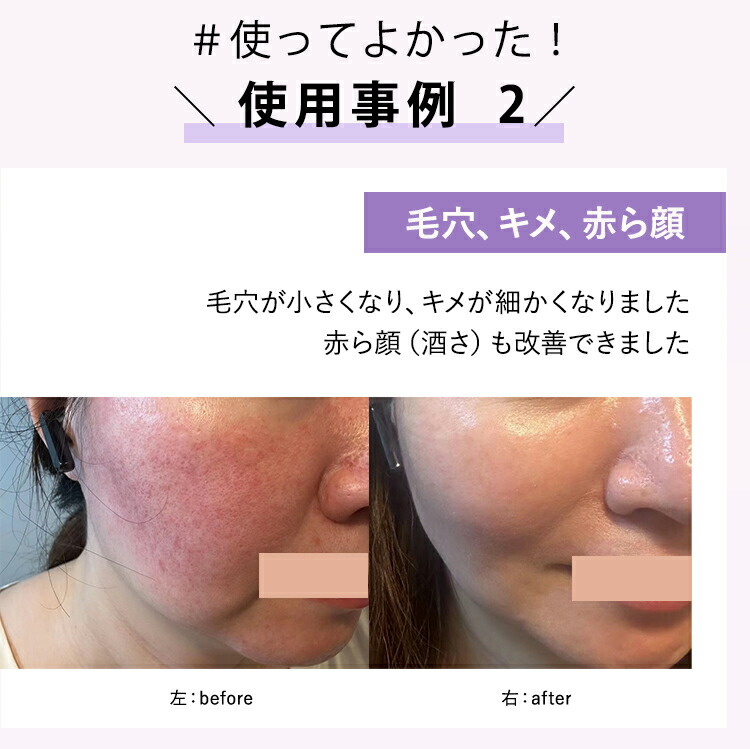 楽天市場】【公式】残り1日！☆5,000円OFFで65,780円 ⇒60,780円+