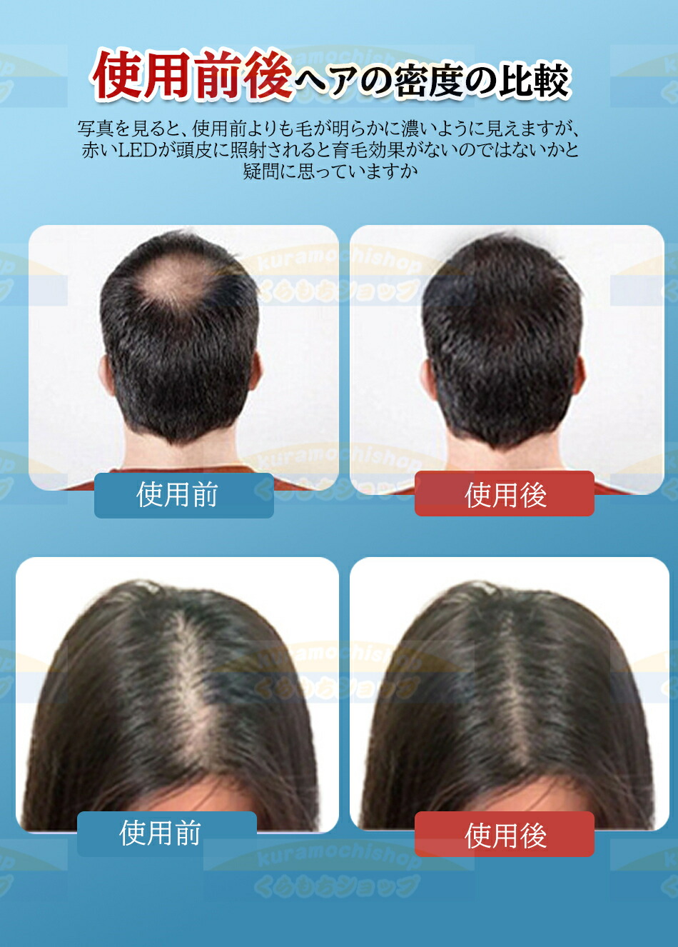 楽天市場】育毛キャップ 育毛システム120個 赤色 led 育毛 赤色光 育毛