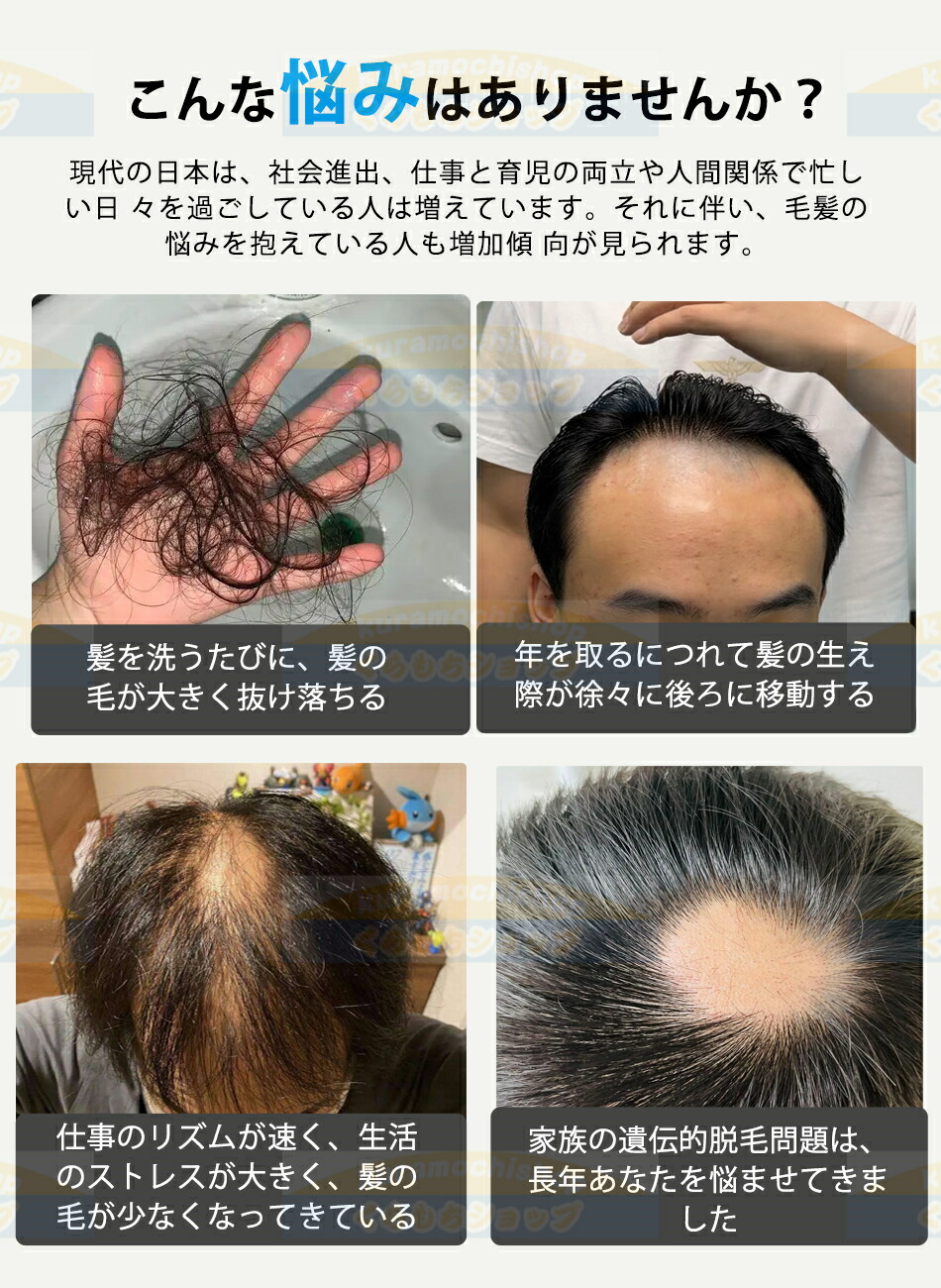 楽天市場】育毛キャップ 赤色LED 育毛システム 180個led 育毛赤色光