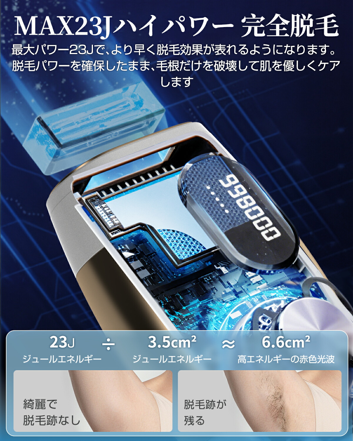 楽天市場】【✨期間限定⇒9680円✨】脱毛器 冷却技術 VIO対応 【2025夏