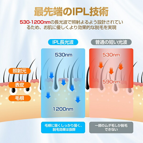 楽天市場】【90日間全額返金保証】 脱毛器 冷感脱毛器 だつもうき IPL