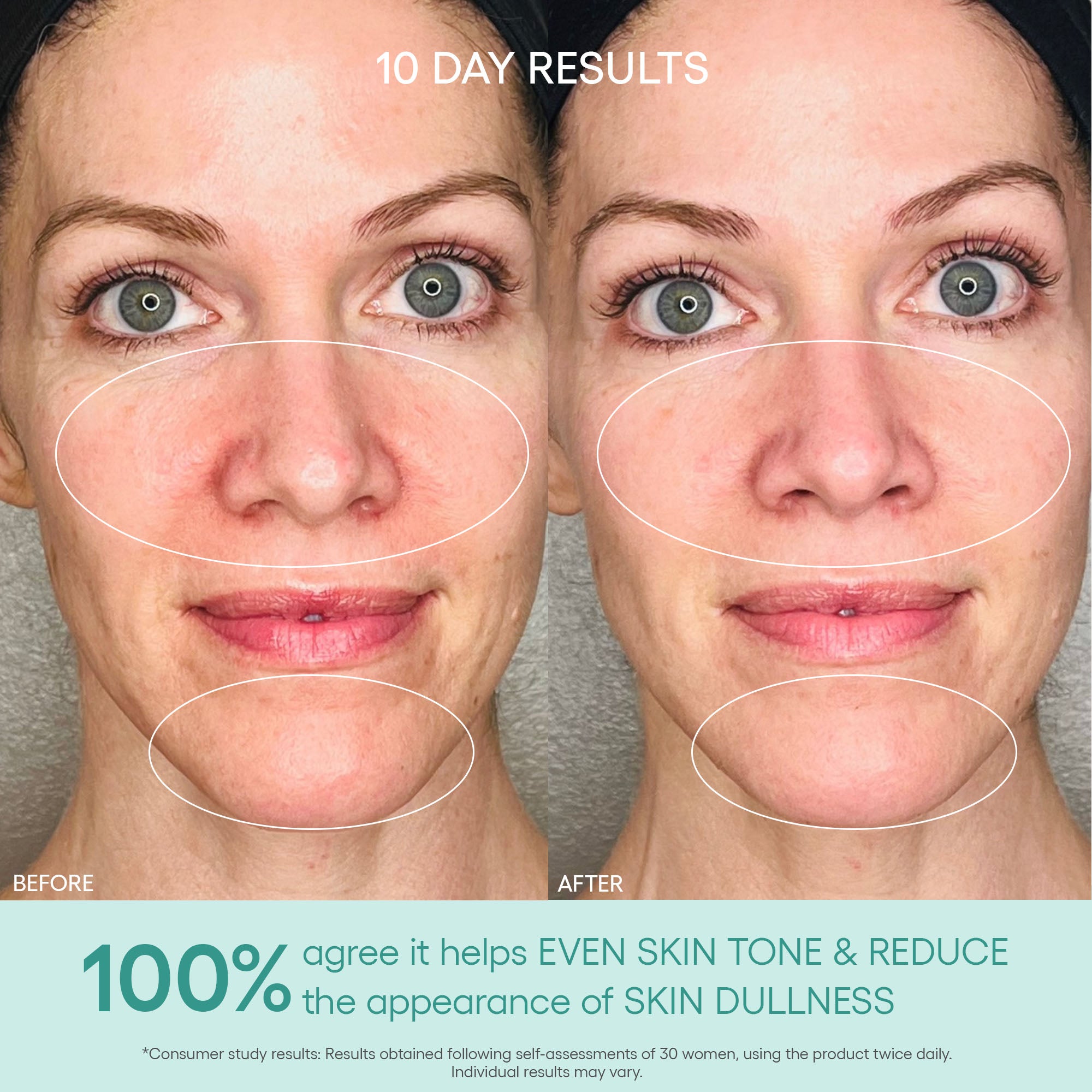 GENIUS Liquid Collagen® Essence – Algenist