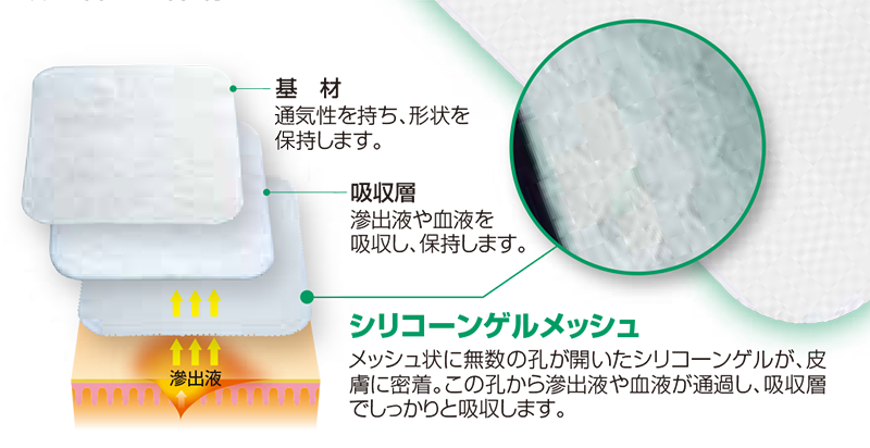 エスアイエイド®｜商品情報（医療関係者向け）