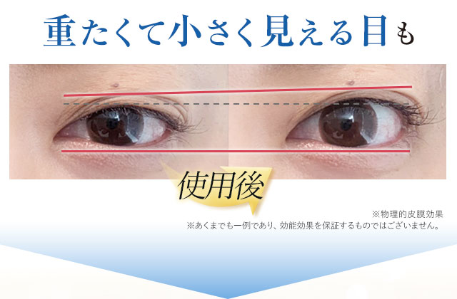 公式】『リッドキララ』まぶたには、まぶたの最終手段