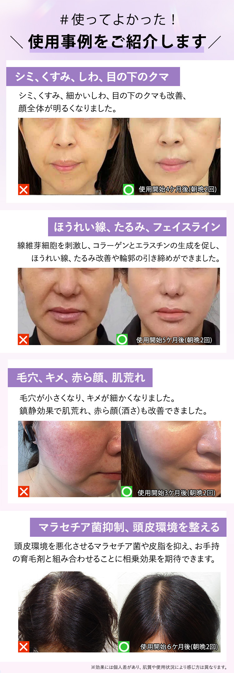 商品詳細 【ポーチ付き】プラズマエアーシャワー美顔器Un（アン）-UN01