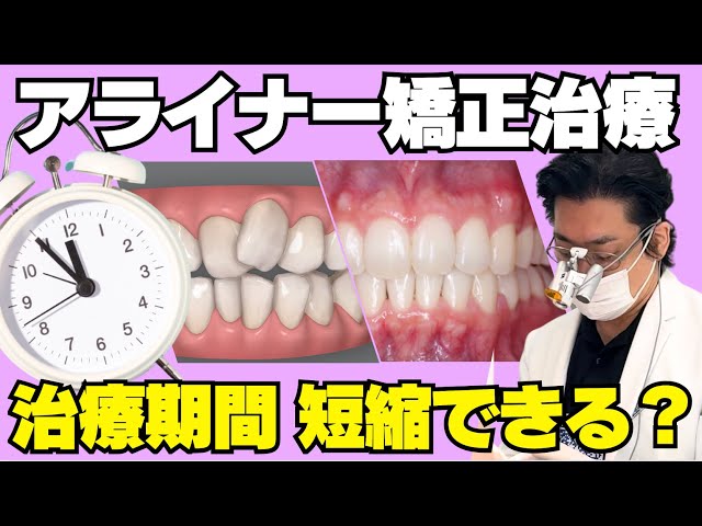 アライナー矯正治療の期間を短くするための工夫を解説します - YouTube