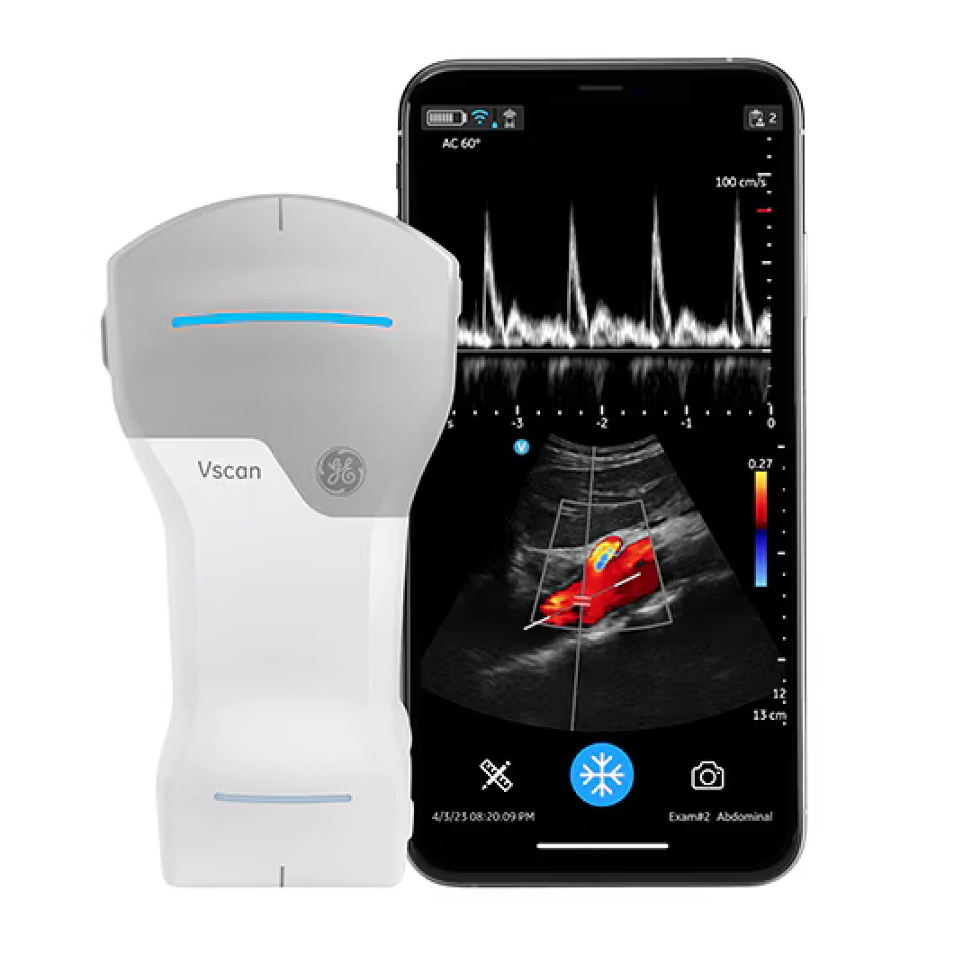 GEヘルスケア製品 ポケットタイプ 超音波診断装置｜株式会社 協栄