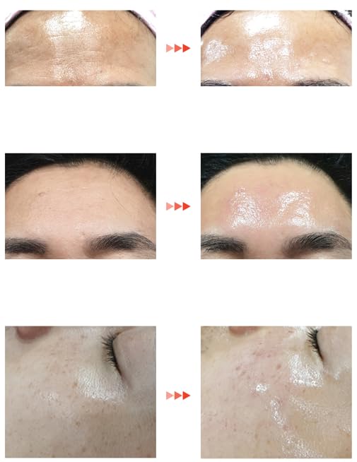 Amazon.co.jp: LHA LALA Peel Set Basic & Ultra ララ ピール