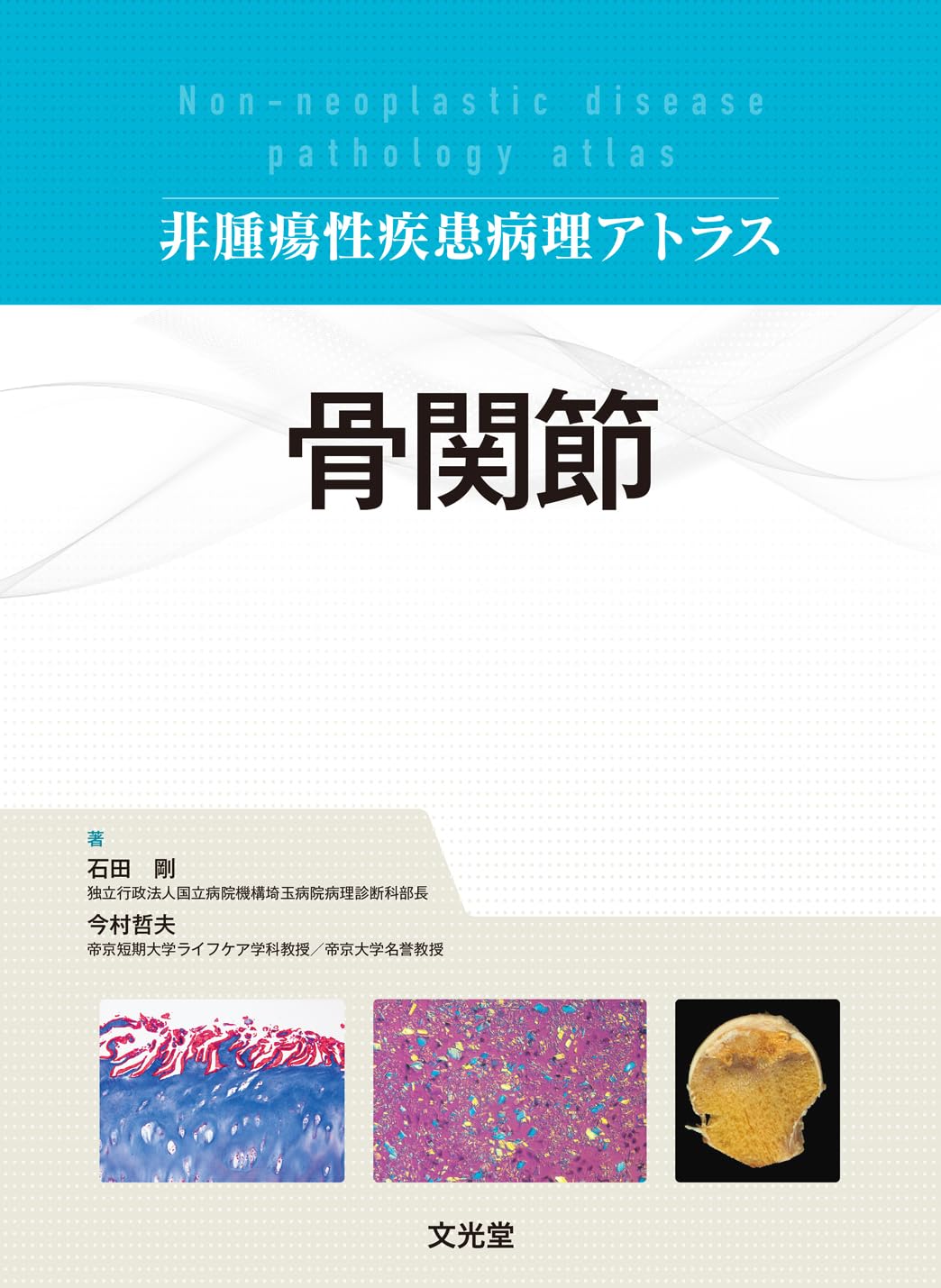 骨関節 (非腫瘍性疾患病理アトラス) | 石田 剛, 今村哲夫 |本 | 通販