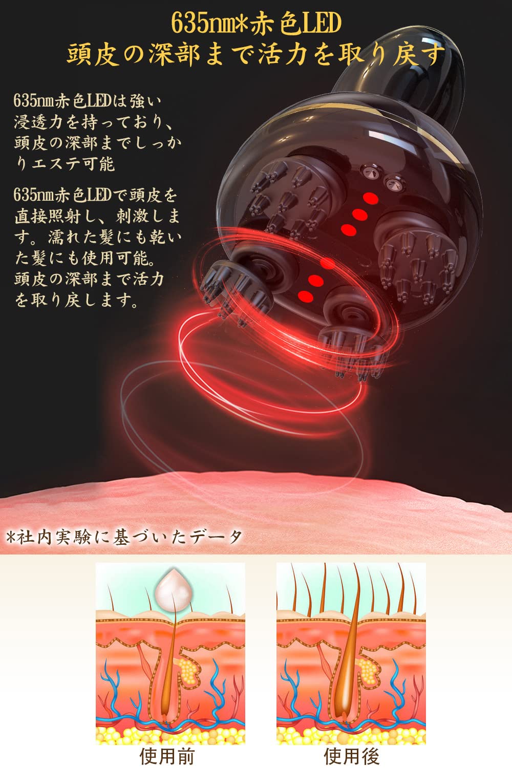 Amazon | Youmay ヘッドスパ EMS 電動頭皮ブラシ 電気針 赤色LED機能