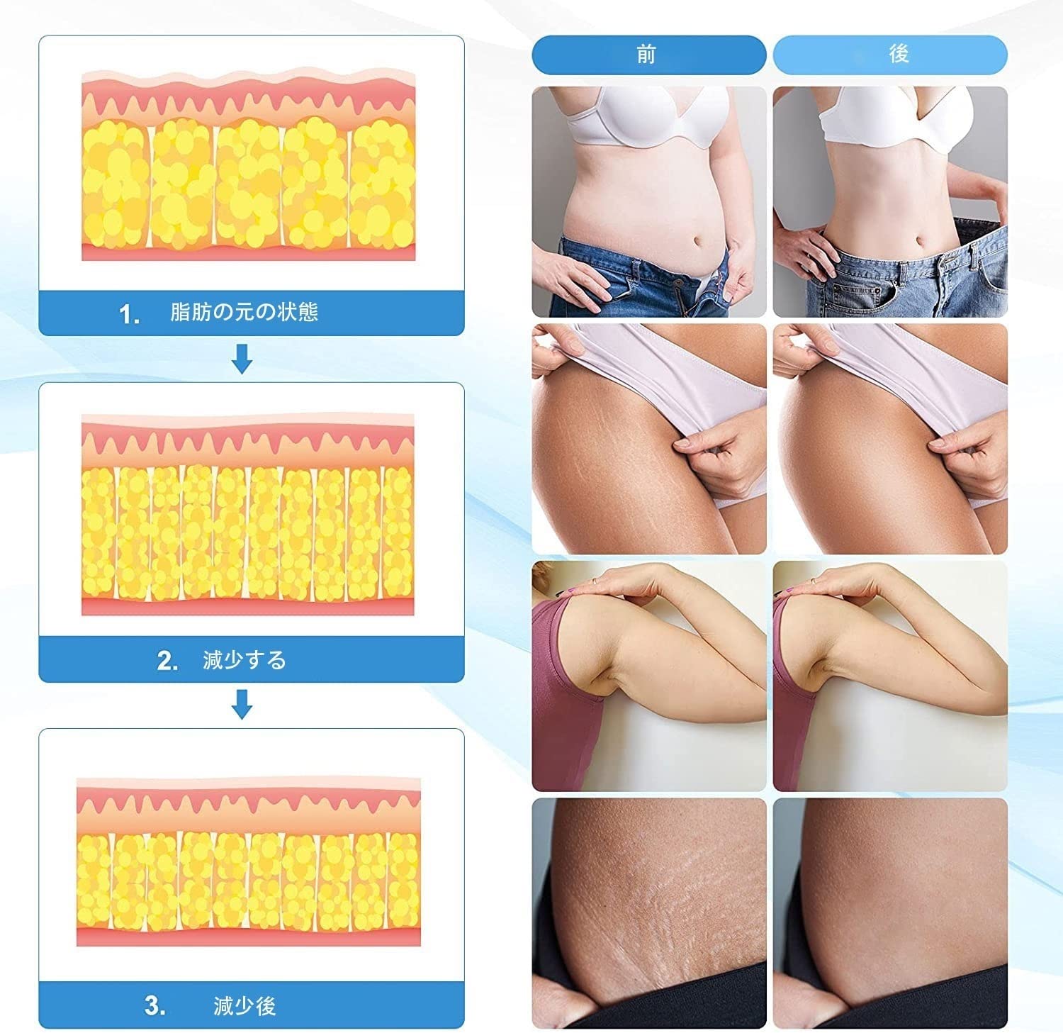 Amazon.co.jp: Muokd 4in1 家庭用/業務用 キャビテーション 40khz 光