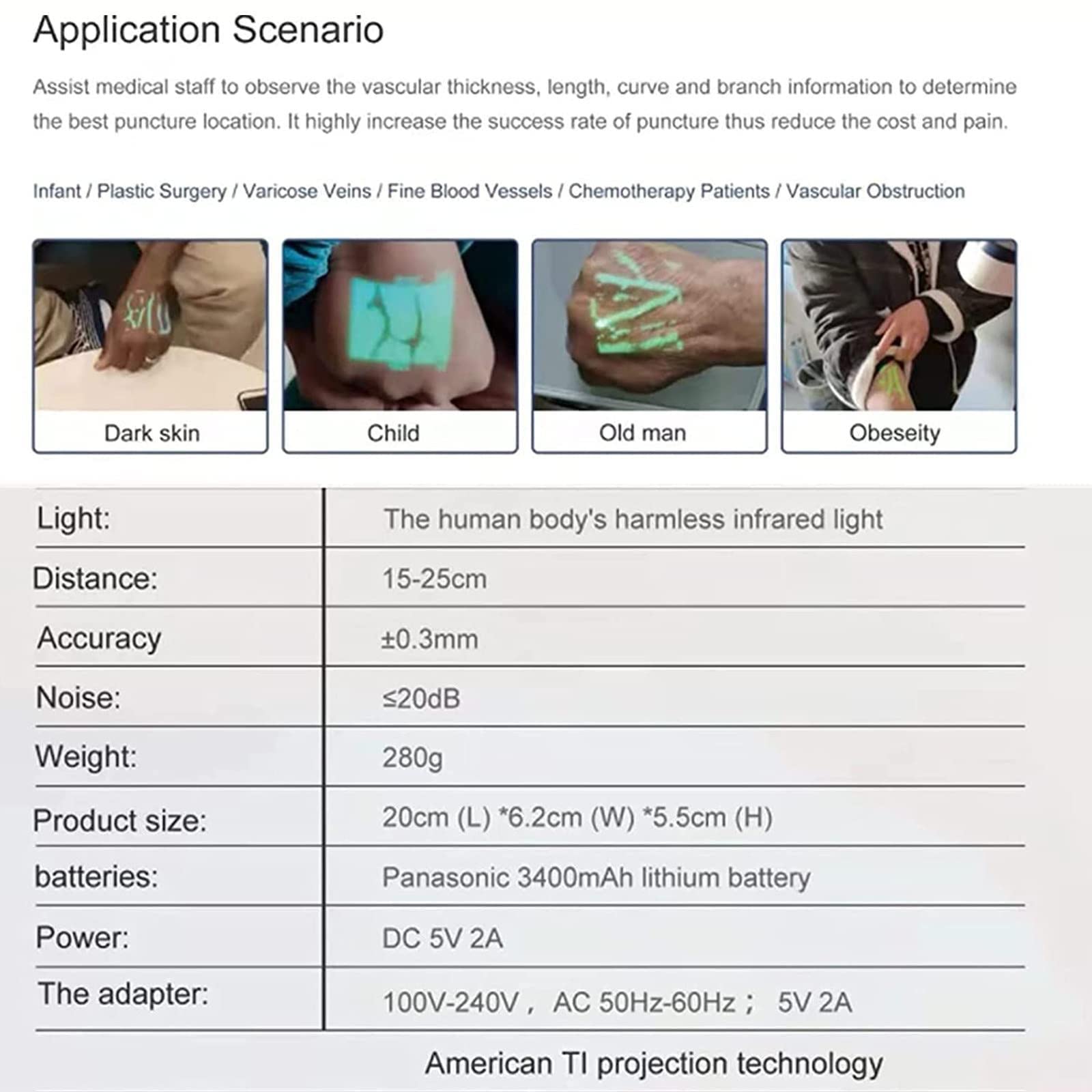 Amazon.com: ZWJABYY Vascular Vein Viewer,Led Vein Finder,Vein