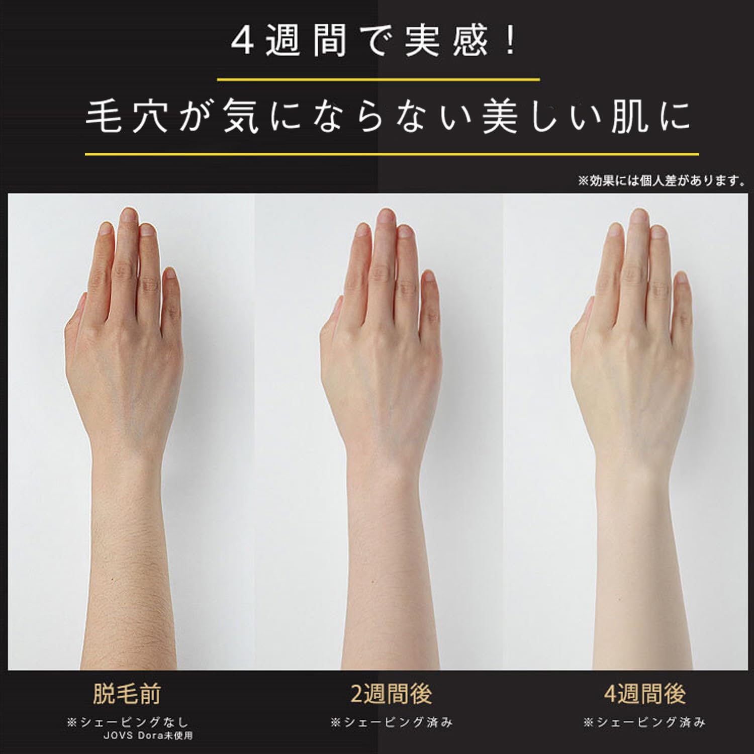 Amazon.co.jp: JOVS Dora J847モデル 脱毛器 家庭用 光美容器 VIO対応