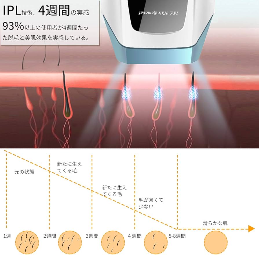 Amazon | 【最新100万発】脱毛器 IPL脱毛器 光脱毛器 10段階調整可能